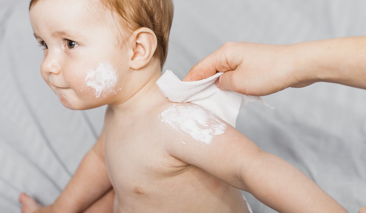 proizvodi za dječju kožu, kako odabrati proizvod za dječju kožu