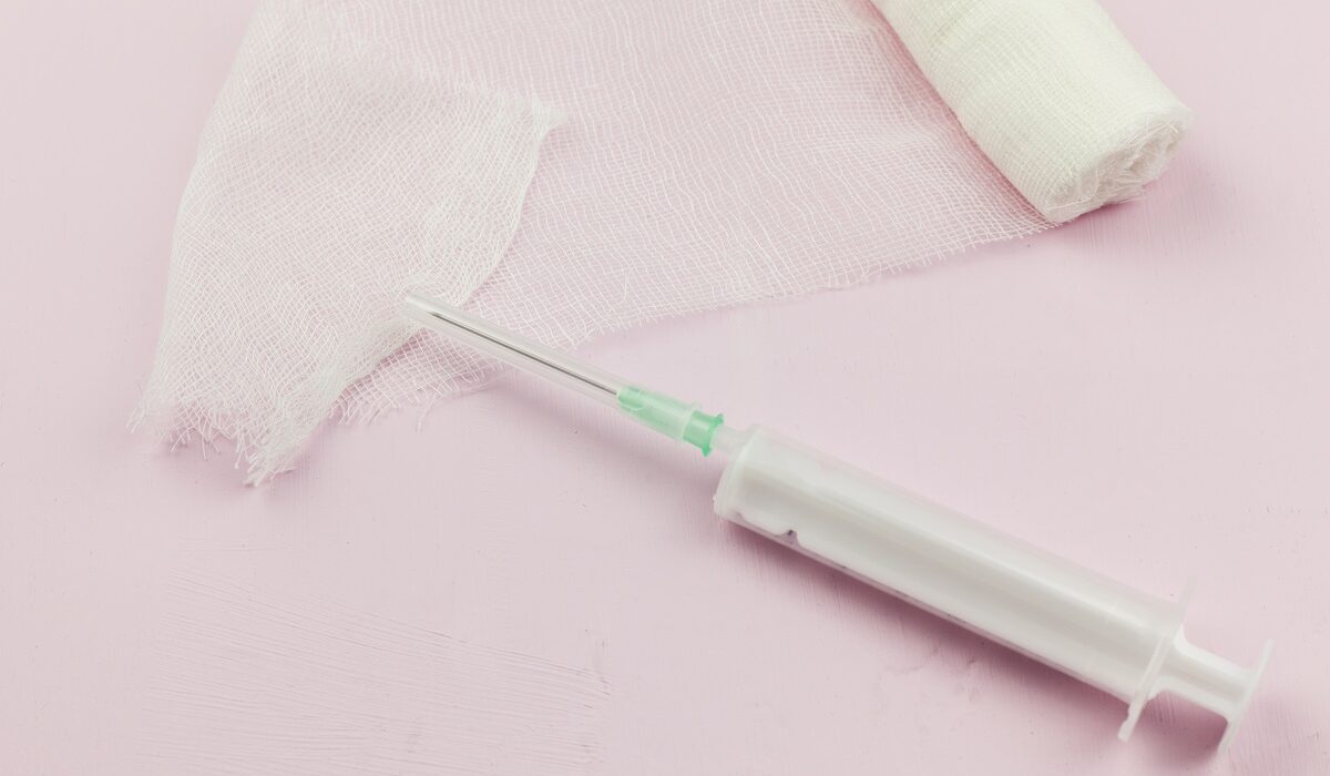 epiduralna anestezija anelgezija