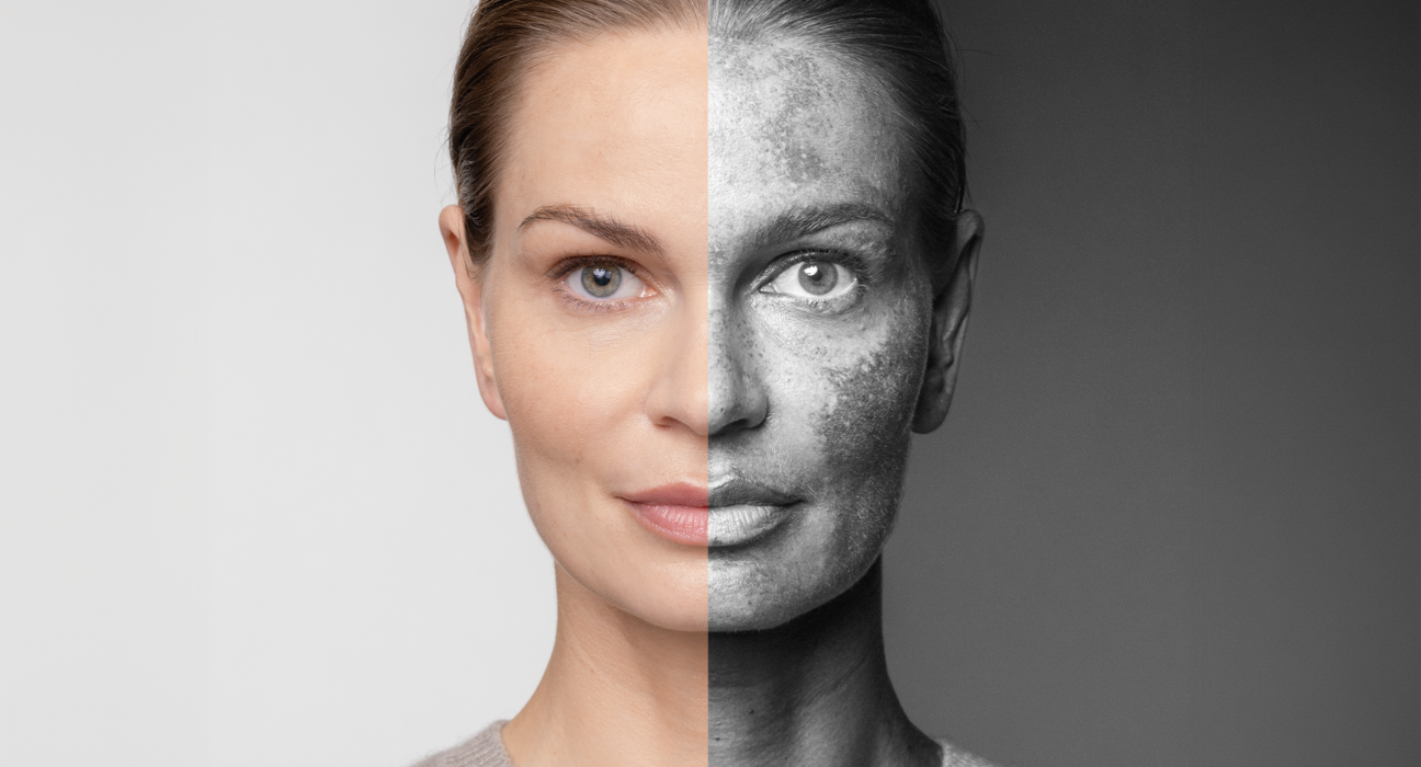 Eucerin Anti-Pigment njega i rutina