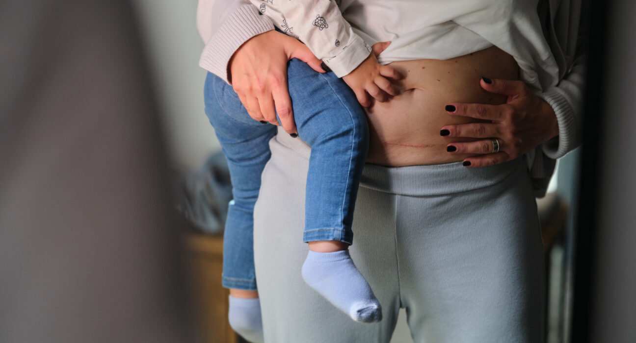 Razlika između prirodnog poroda i carskog reza