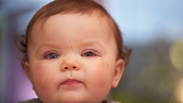 zdravstveni problemi djece